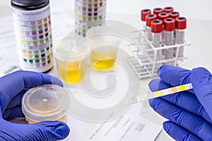 Urinalysis with reagent strips to analyze Leukocytes, Urobilinogen, Bilirubin, Blood, Nitrite, pH, Density, Protein, Glucose and