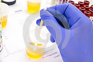 Urinalysis with reagent strips to analyze Leukocytes, Urobilinogen, Bilirubin, Blood, Nitrite, pH, Density, Protein, Glucose and