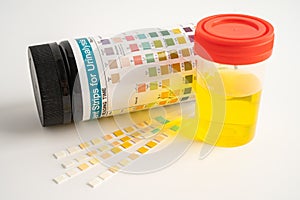 Urinalysis, urine cup with reagent strip pH paper test and comparison chart in laboratory photo