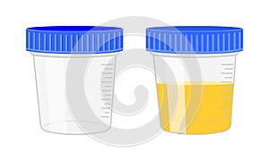 Urinalysis. Urine sample, empty and full plastic containers. Laboratory examination and diagnostics concept. Vector photo