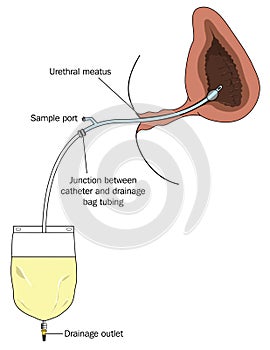 Urinary bladder collection bag