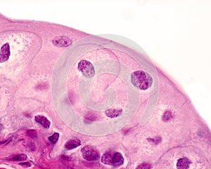 Urinary bladder. Epithelium