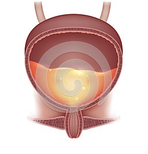 Urinary bladder with urine