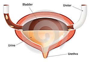 Urinary bladder with urine photo