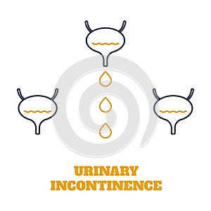 Urinary incontinence bladder disease awareness medical diagram