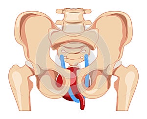 Urinary incontinence tension-free vaginal tape TVT female stress urinary incontinence therapy Female system Front view