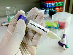Urine amylase test