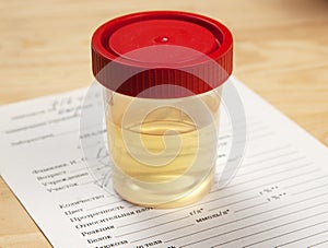 Urine analysis