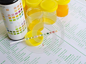 Urine analysis