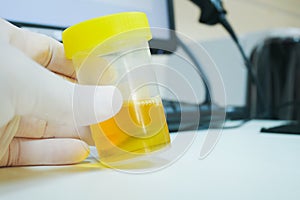 Urine analysis in laboratory