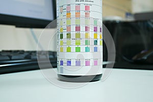 Urine analysis in laboratory