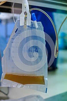 Urine bag hanging beside the patient`s bed.