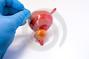 Urine bladder suprapubic puncture biopsy or cystoscopy procedure. Urologist holding needle and makes body puncture of anatomical u