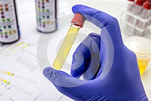 Urine bottle held by healthcare professionals with latex glove, toxicology test photo
