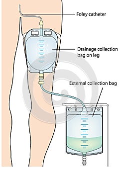 Urine collection bag