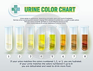 Urine Color Chart 1