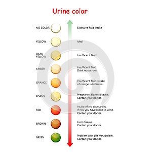 Urine Color. Chart for Assessing hydration and dehydration photo