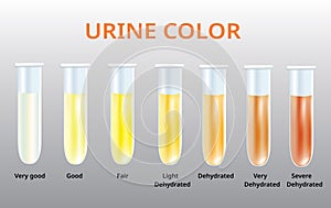 Urine color chart, Urine in Test tubes, medical vector photo