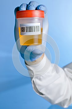 Urine container with code bar in blue background