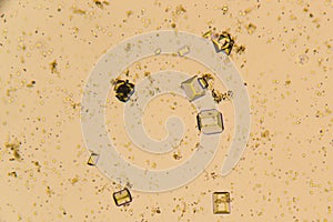 Urine crystals, red blood cells and leukocytes at the microscope. Urinary tract disease in cat