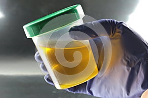 Urine drug testing