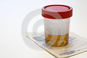 Urine jar, urinalysis. Disposable container for taking biomaterial.