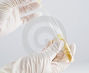 Urine sample photo