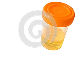 Urine sample