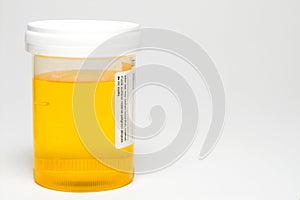 Urine Sample photo