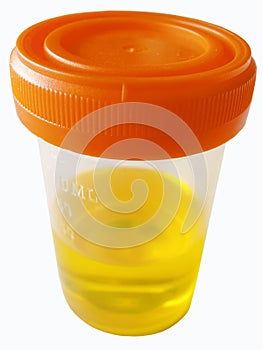 Urine sample