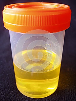 Urine sample