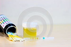 Urine sample along with dip stick uristix for analyzing urine glucose protein in diabetes