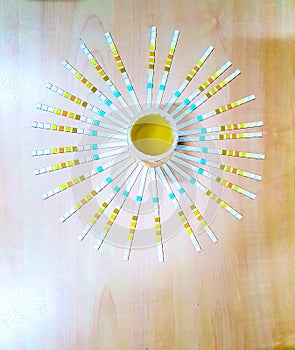 Urine sample along with dip stick uristix for analyzing urine glucose protein in diabetes