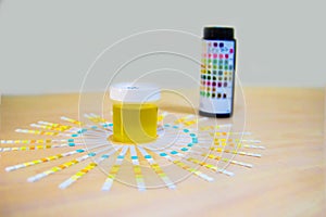 Urine sample along with dip stick uristix for analyzing urine glucose protein in diabetes