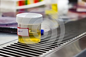 Urine sample in an asceptic container for laboratory pathological biochemical microbiological and cytological analysis photo