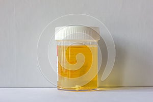Urine sample collected in a container for urine culture which is  on a white background.