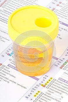 Urine sample on a lab form