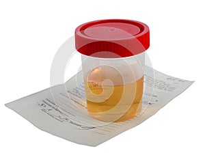 Urine Sample