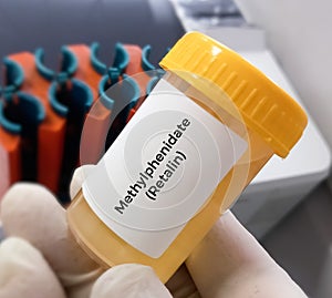 Urine sample for Methylphenidate or Retalin test. Stimulant used for attention deficit hyperactivity disorder