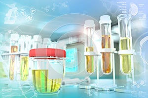 Urine sample test for casts or amorphous phosphates - proofs in modern science college clinic, medical 3D illustration