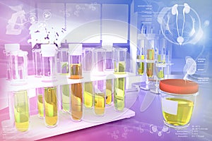 Urine sample test for leukocyte esterase or diabetes - test tubes in modern medical university facility, medical 3D illustration