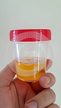 Urine specimen plastic box and hand