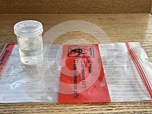 Urine specimen in transparent plastic bottle