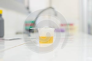 Urine specimen for Urine examination