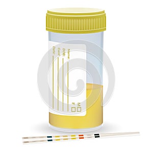 Urine Test Strip With The Plastic Jar Of Urine. Medical Examination On A White Background. Realistic Vector