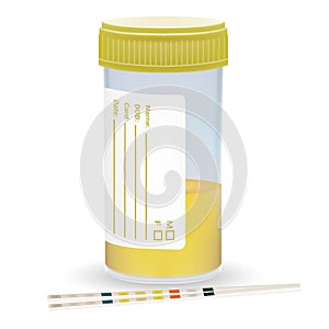 Urine Test Strip With The Plastic Jar Of Urine. Medical Examination On A White Background. Realistic Vector photo