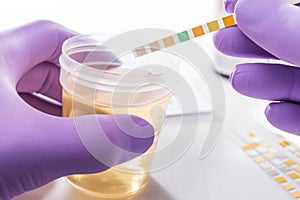 Urine test strips in purple gloves