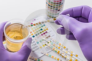 Urine test strips in purple gloves