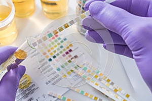 Urine test strips in purple gloves