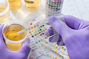 Urine test strips in purple gloves